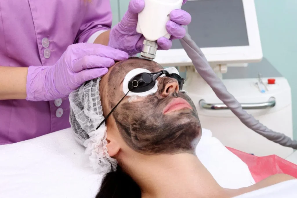 Carbon Laser Face​