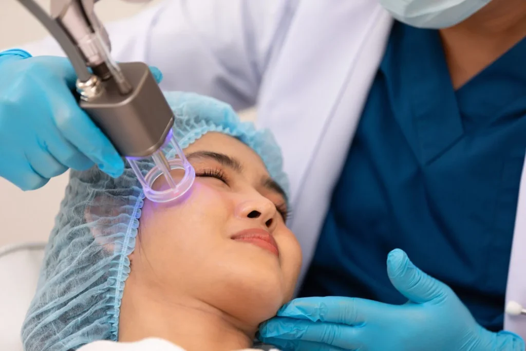 RF Microneedling​