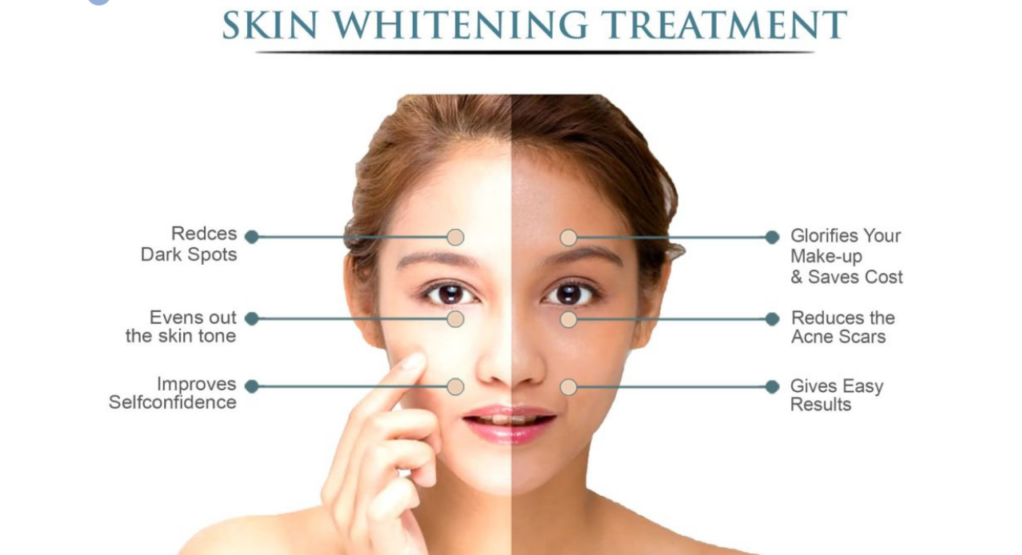 Skin Whitening Treatment