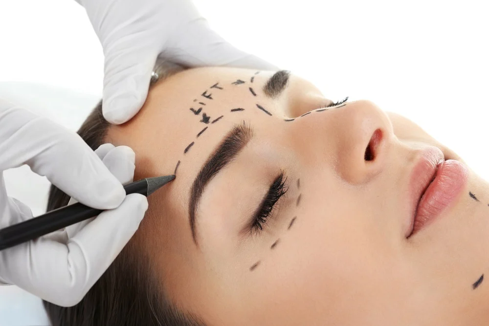 Eyebrow transplant procedure showing natural eyebrow hair restoration results