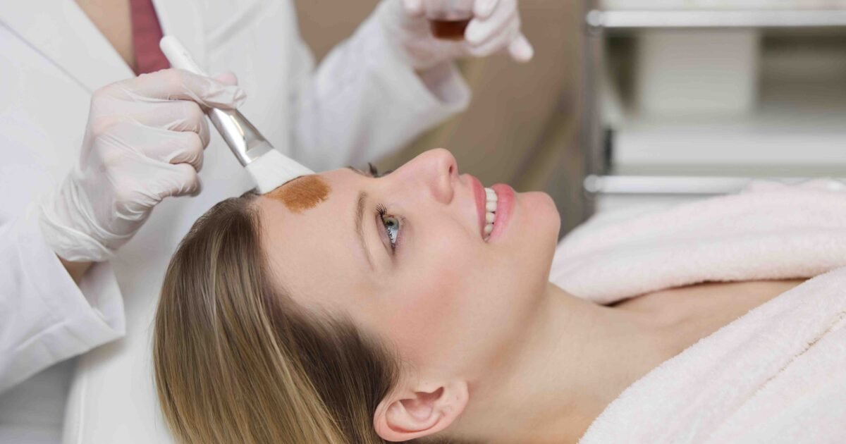 Chemical Peel for Pigmentation