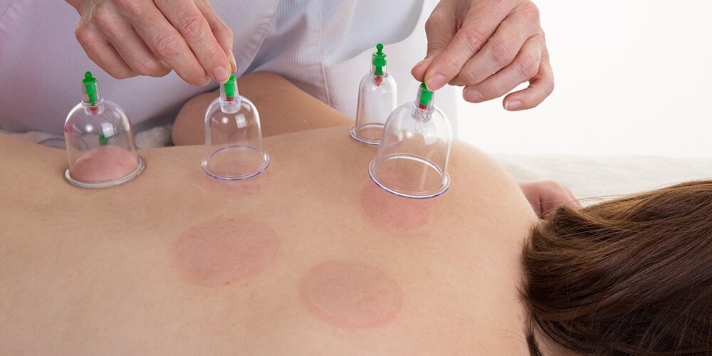 Hijama Aftercare