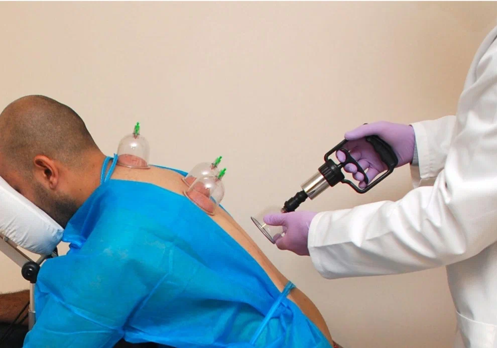 Hijama therapy session at Larosh Medical Clinic in Dubai
