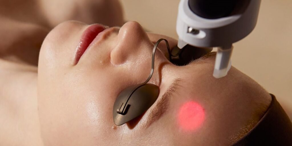 Laser Treatment for Pigmentation
