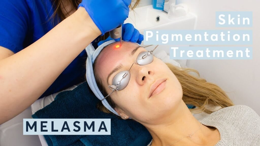 Melasma: Brown or gray-brown patches caused by hormonal changes.